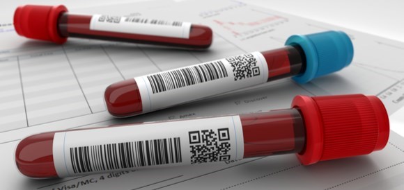 בדיקת נחושת (Copper) - תמונה